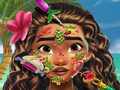 Juego Doctora de la piel Moana en línea