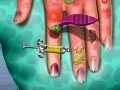 Juego Doctor de la piel de las manos en línea