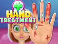Juego Tratamiento de manos en línea